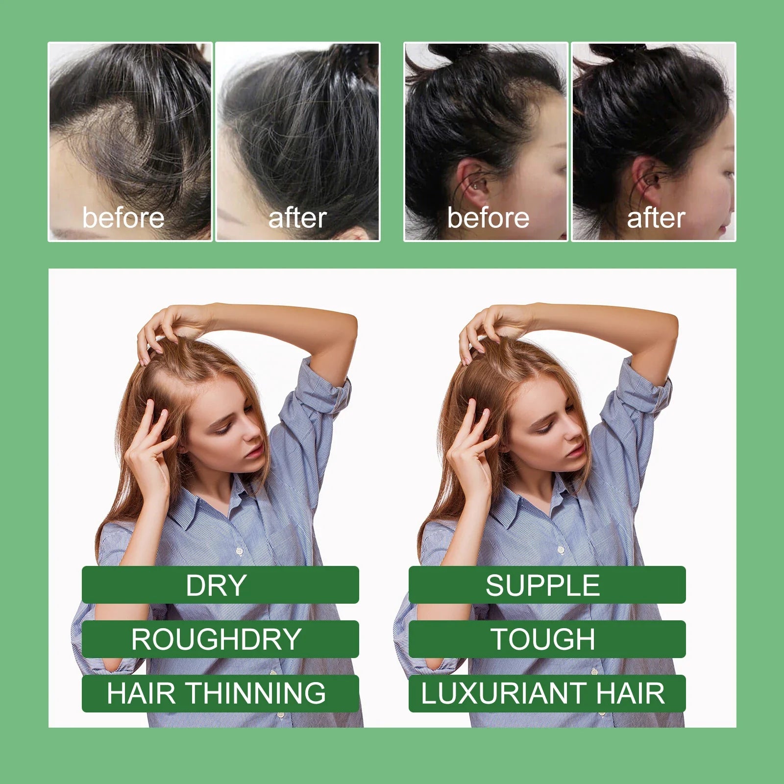 Superior Hair Essential Oil For Healthy Regrowing Hair,Repairs Damaged Hair Anti-Hair Loss Hair Care Essence For All Hair Types
