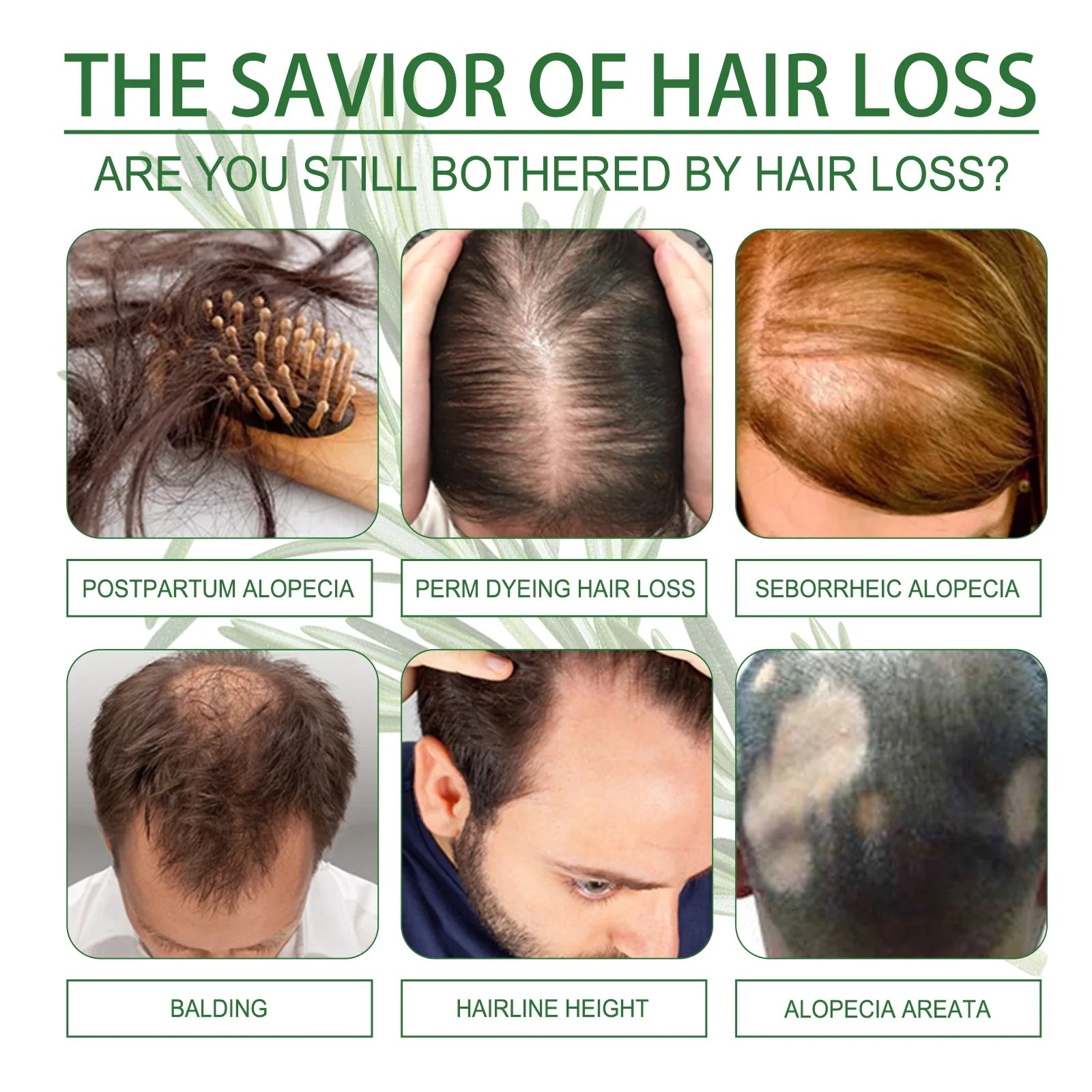 Superior Hair Essential Oil For Healthy Regrowing Hair,Repairs Damaged Hair Anti-Hair Loss Hair Care Essence For All Hair Types